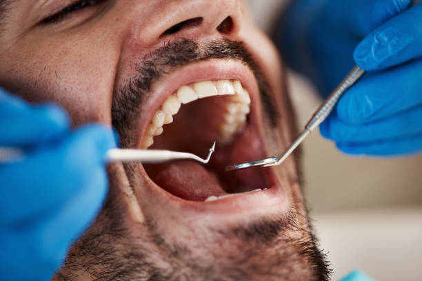 Best Dental Abscess Treatment in Herscher, IL